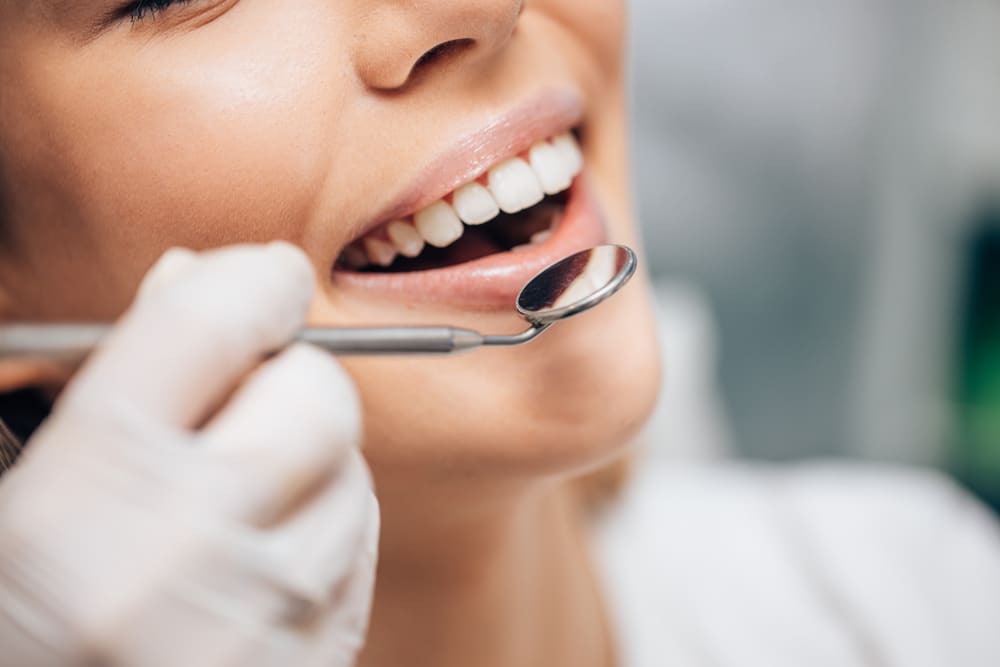 Dental Cleanings in Winchester