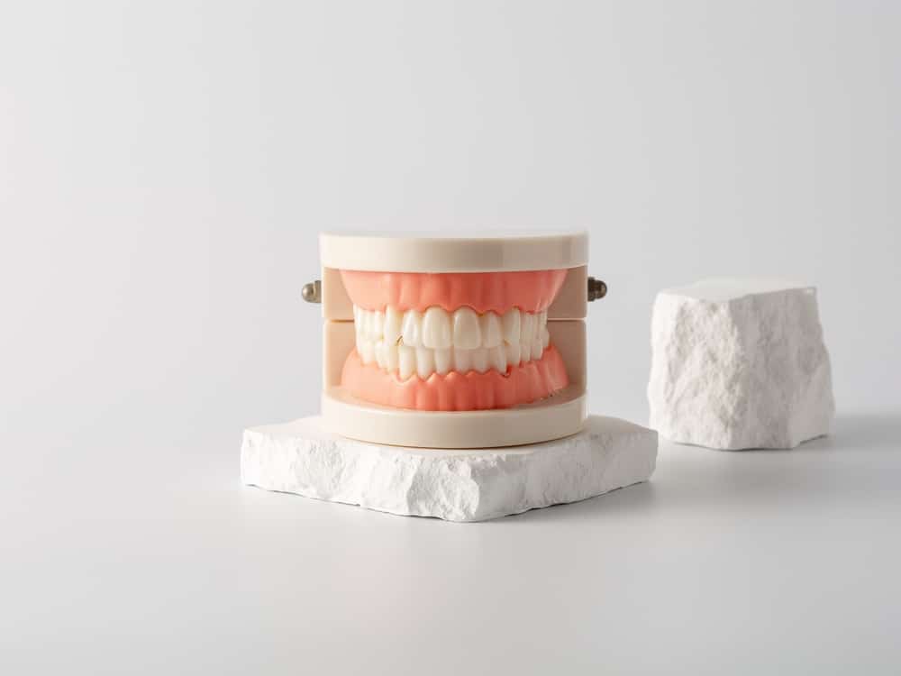 Model,Dentures,On,White,Background